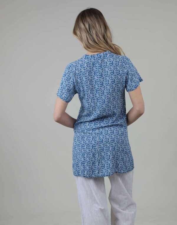 טוניקת ויסקוזה