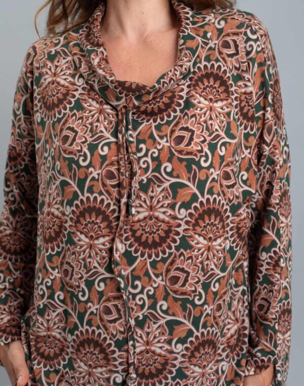 טוניקת אוברסייז