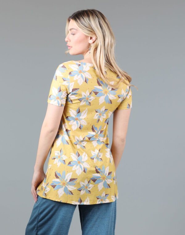 טוניקה מודפסת